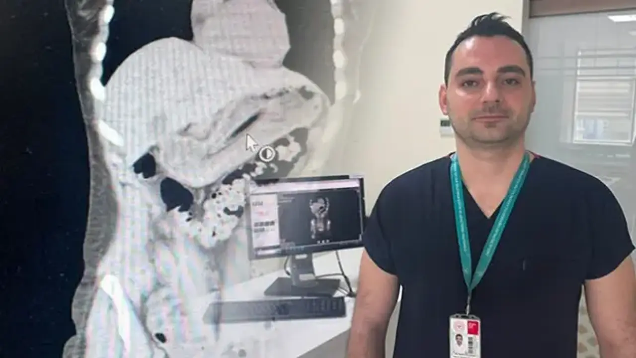 Doktorları şaşkına çeviren vaka! Zayıflamak isterken yuttu