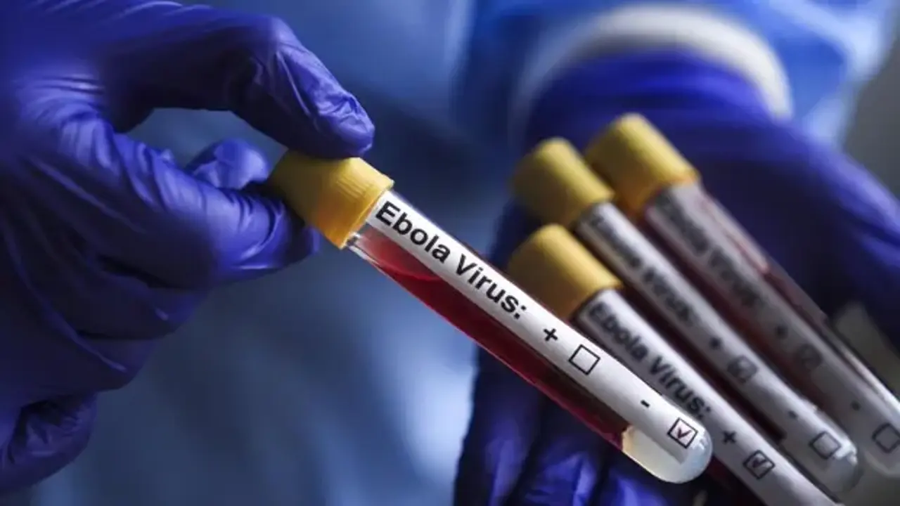 İsrail’de ilk Ebola şüphesi! Bir kişi karantinaya alındı