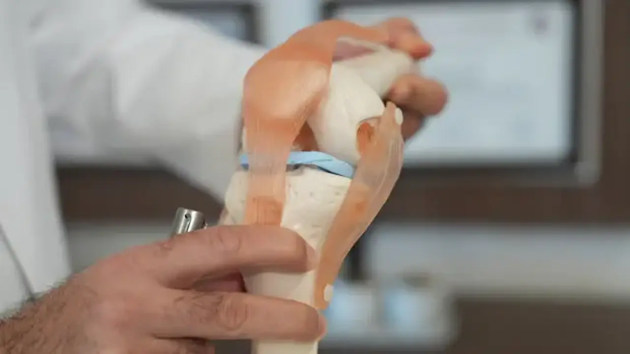 Menisküs kaybına hastanın kendi dokusundan kalıcı çözüm