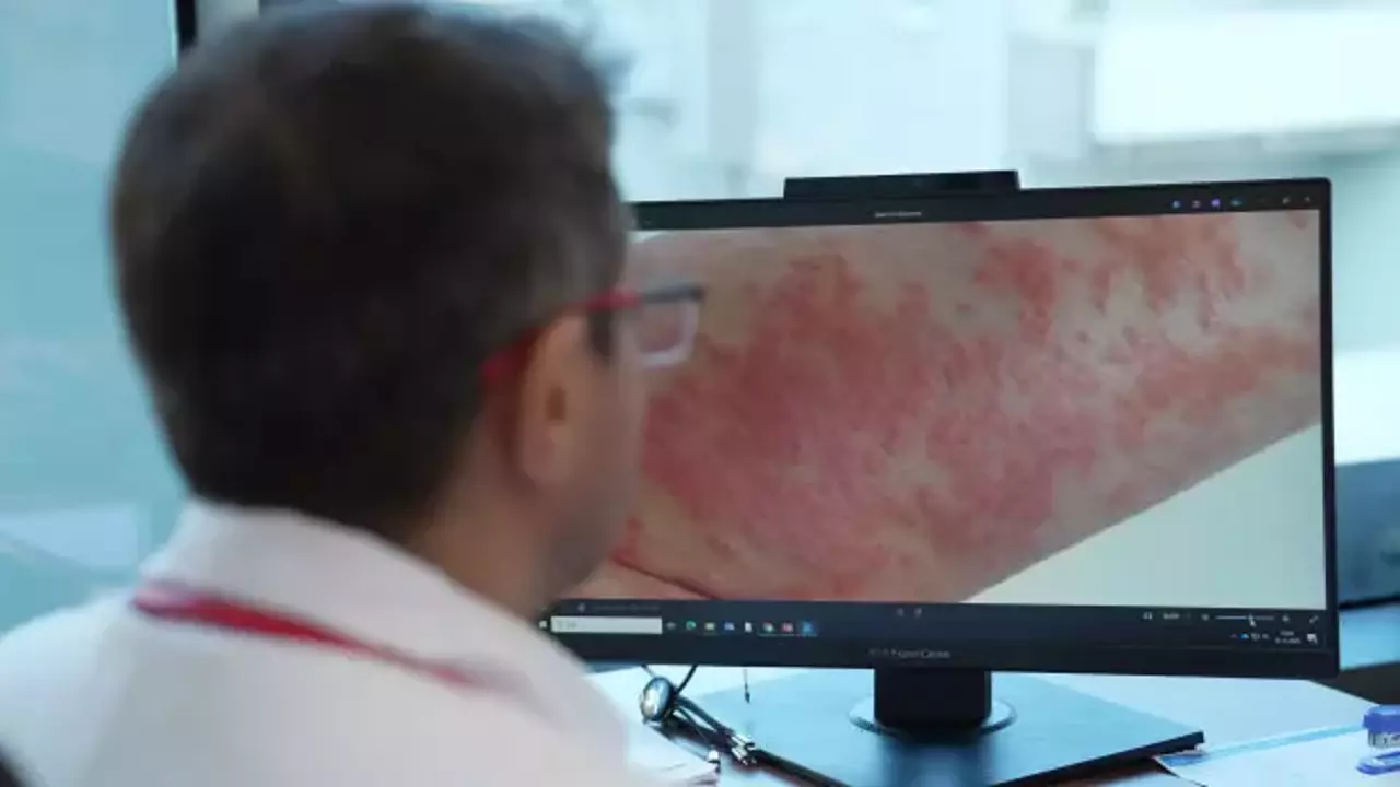 Uzmanından uyarı: Egzamalı çocuğa ezbere diyet yaptırmayın